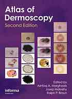 Atlas Of Dermoscopy Ashfaq A Marghoob Ralph Braun