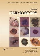 Atlas Of Dermoscopy Ashfaq A Marghoob Ralph P Braun Alfred W Kopf