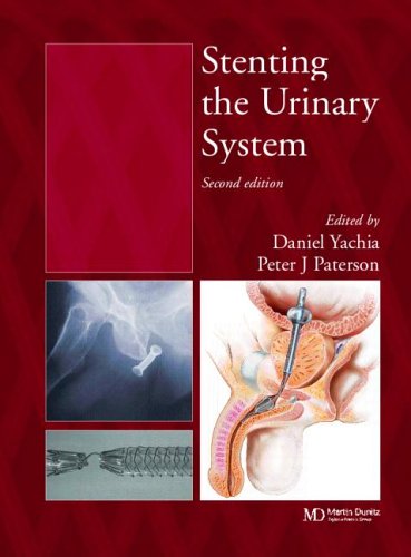 Stenting The Urinary System Second Edition 2nd Edition Daniel Yachia