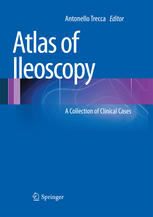 Atlas Of Ileoscopy A Collection Of Clinical Cases 1st Edition Antonello Trecca