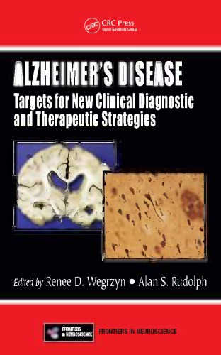 Alzheimers A Caregivers Guide And Sourcebook 3rd Howard Gruetzner