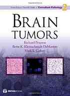 Brain Tumors Richard A Prayson Mark L Cohen Bette Kleinschmidtdemasters