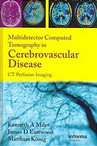Multidetector Computed Tomography In Cerebrovascular Disease Ct Perfusion Imaging Kenneth Miles James D Eastwood Matthias Konig