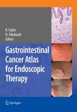 Gastrointestinal Cancer Atlas For Endoscopic Therapy 1st Edition Tomohiro Tsuchida Auth
