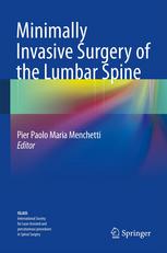 Minimally Invasive Surgery Of The Lumbar Spine 1st Edition Angelo Chierichini Md