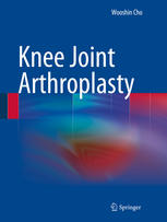 Knee Joint Arthroplasty 1st Edition Wooshin Cho Auth