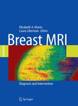 Breast Mri Diagnosis And Intervention 1st Edition Elizabeth A Morris Md