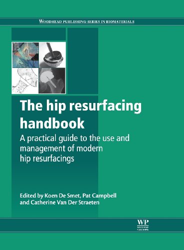 The Hip Resurfacing Handbook A Practical Guide To The Use And Management Of Modern Hip Resurfacings 1 Harchrt Dr Koen De Smet