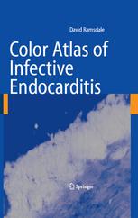 Color Atlas Of Infective Endocarditis 1st Edition David R Ramsdale Bsc