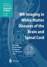 Mr Imaging In White Matter Diseases Of The Brain And Spinal Cord 1st Edition Mark A Horsfield Phd Auth