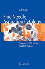 Fine Needle Aspiration Cytology Diagnostic Principles And Dilemmas 1st Edition Dr Gabrijela Kocjan Auth