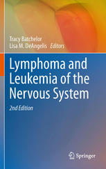 Lymphoma And Leukemia Of The Nervous System 1st Edition Nikolai Podoltsev