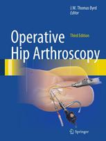 Operative Hip Arthroscopy 3rd Edition J W Thomas Byrd Md Auth