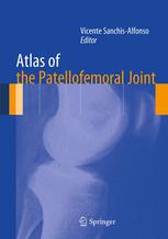 Atlas Of The Patellofemoral Joint 1st Edition Vicente Sanchisalfonso Md