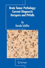 Brain Tumor Pathology Current Diagnostic Hotspots And Pitfalls 1st Edition Davide Schiffer Auth