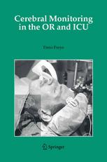 Cerebral Monitoring In The Or And Icu 1st Edition Enno Freye Md