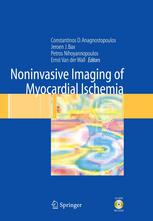 Noninvasive Imaging Of Myocardial Ischemia 1st Edition Mark Harbinson Md