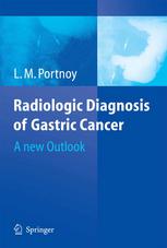 Radiologic Diagnosis Of Gastric Cancer A New Outlook Dr L M Portnoy Auth