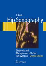 Hip Sonography Diagnosis And Management Of Infant Hip Dysplasia 2nd Edition Univ Prof Prim Dr Reinhard Graf Auth