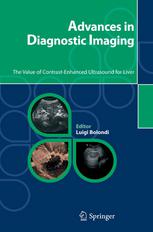 Advances In Diagnostic Imaging The Value Of Contrastenhanced Ultrasound For Liver 1st Edition Riccardo Lencioni