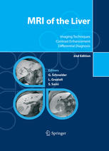 Mri Of The Liver Imaging Techniques Contrast Enhancement Differential Diagnosis 2nd Edition Gnther Schneider Md
