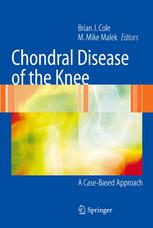 Chondral Disease Of The Knee A Casebased Approach 1st Edition Brian J Cole Md