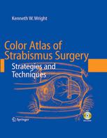 Color Atlas Of Strabismus Surgery Strategies And Techniques 3rd Edition Kenneth W Wright