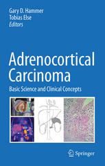 Adrenocortical Carcinoma Basic Science And Clinical Concepts 1st Edition David E Schteingart Auth