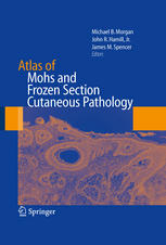Atlas Of Mohs And Frozen Section Cutaneous Pathology 1st Edition Michael B Morgan Md