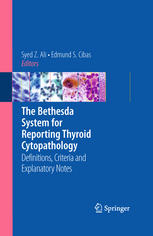 The Bethesda System For Reporting Thyroid Cytopathology Definitions Criteria And Explanatory Notes 1st Edition Zubair W Baloch Md