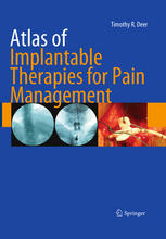 Atlas Of Implantable Therapies For Pain Management 1st Edition Timothy R Deer Auth