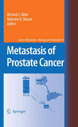 Metastasis Of Prostate Cancer 1st Edition Richard J Ablin Malcolm D Mason Auth
