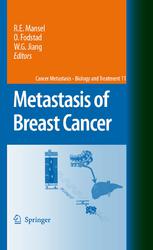 Metastasis Of Breast Cancer 1st Edition Robert E Mansel Ms Frcs