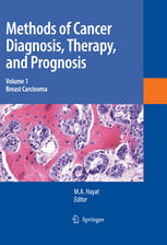 Methods Of Cancer Diagnosis Therapy And Prognosis Breast Carcinoma 1st Edition M A Hayat Auth