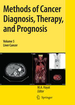 Liver Cancer 1st Edition Amir H Khandani Auth M A Hayat Eds