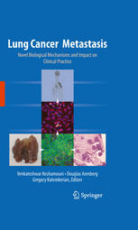 Lung Cancer Metastasis Novel Biological Mechanisms And Impact On Clinical Practice 1st Edition Shirish M Gadgeel