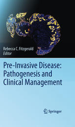 Preinvasive Disease Pathogenesis And Clinical Management 1st Edition Nicholas A Wright Auth