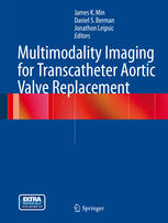 Multimodality Imaging For Transcatheter Aortic Valve Replacement 1st Edition James K Min Md