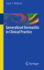 Generalized Dermatitis In Clinical Practice 1st Edition Susan T Nedorost Auth