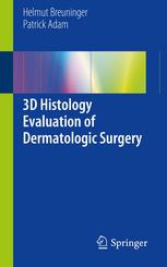 3d Histology Evaluation Of Dermatologic Surgery 1st Edition Helmut Breuninger