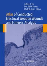 Atlas Of Conducted Electrical Weapon Wounds And Forensic Analysis 1st Edition Paul C Nystrom Md Auth