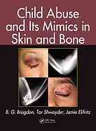 Child Abuse And Its Mimics In Skin And Bone B G Brogdon Tor Shwayder Jamie Elifritz