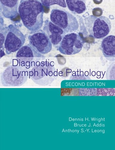 Diagnostic Lymph Node Pathology 2nd Edition 2nd Edition Dennis Wright