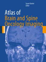 Atlas Of Brain And Spine Oncology Imaging 1st Edition Gitanjali V Patel
