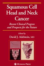 Squamous Cell Head And Neck Cancer Recent Clinical Progress And Prospects For The Future 1st Edition Gypsyamber Dsouza Ms