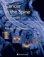 Cancer In The Spine Comprehensive Care 1st Edition Kaiuwe Lewandrowski Md