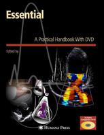 Essential Echocardiography A Practical Handbook With Dvd 1st Edition Scott D Solomon Md Auth