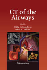 Ct Of The Airways 1st Edition Kathryn Chmura Stella Hines Edward D Chan Auth