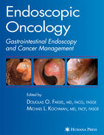 Endoscopic Oncology Gastrointestinal Endoscopy And Cancer Management 1st Edition Glenn M Eisen Md