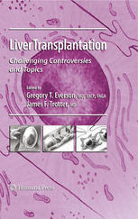 Liver Transplantation Challenging Controversies And Topics 1st Edition David A Bruno